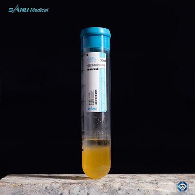 15 مللي أنابيب PRP تخفف الألم ACD-A PRP Gel Separator Tubes